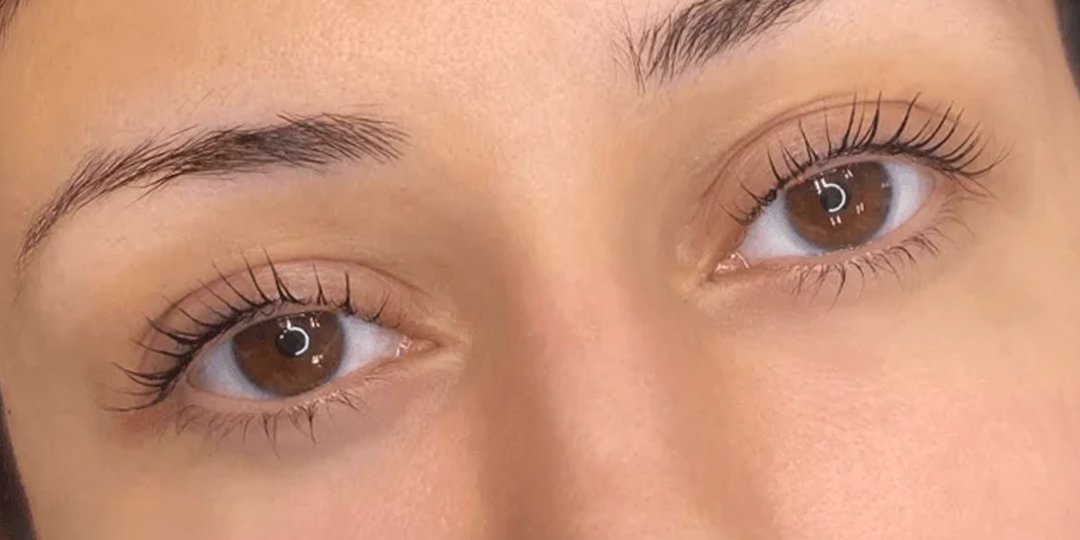 SSkin-BeforeAfter2_01