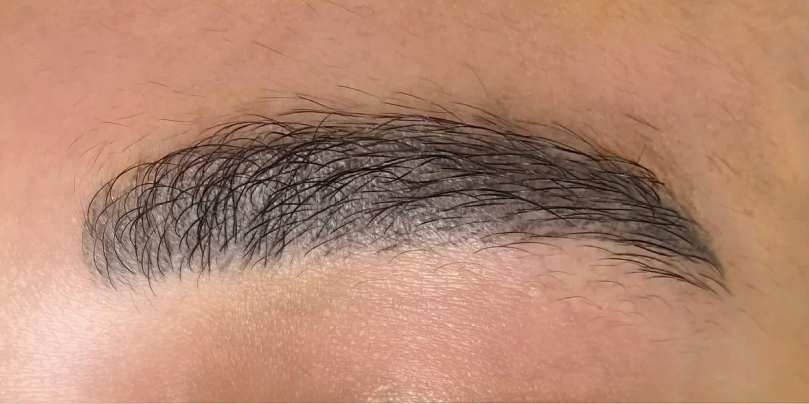 SSkin-BeforeAfter3_01