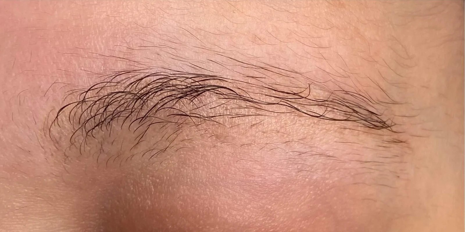 SSkin-BeforeAfter3_02